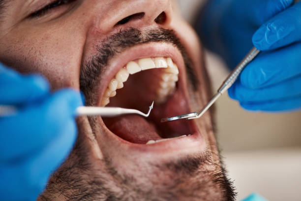 Best Dentist for Tooth Abscess  in Belmont, WI