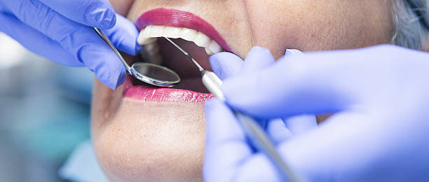 Best Dentist for Tooth Abscess  in Belmont, WI